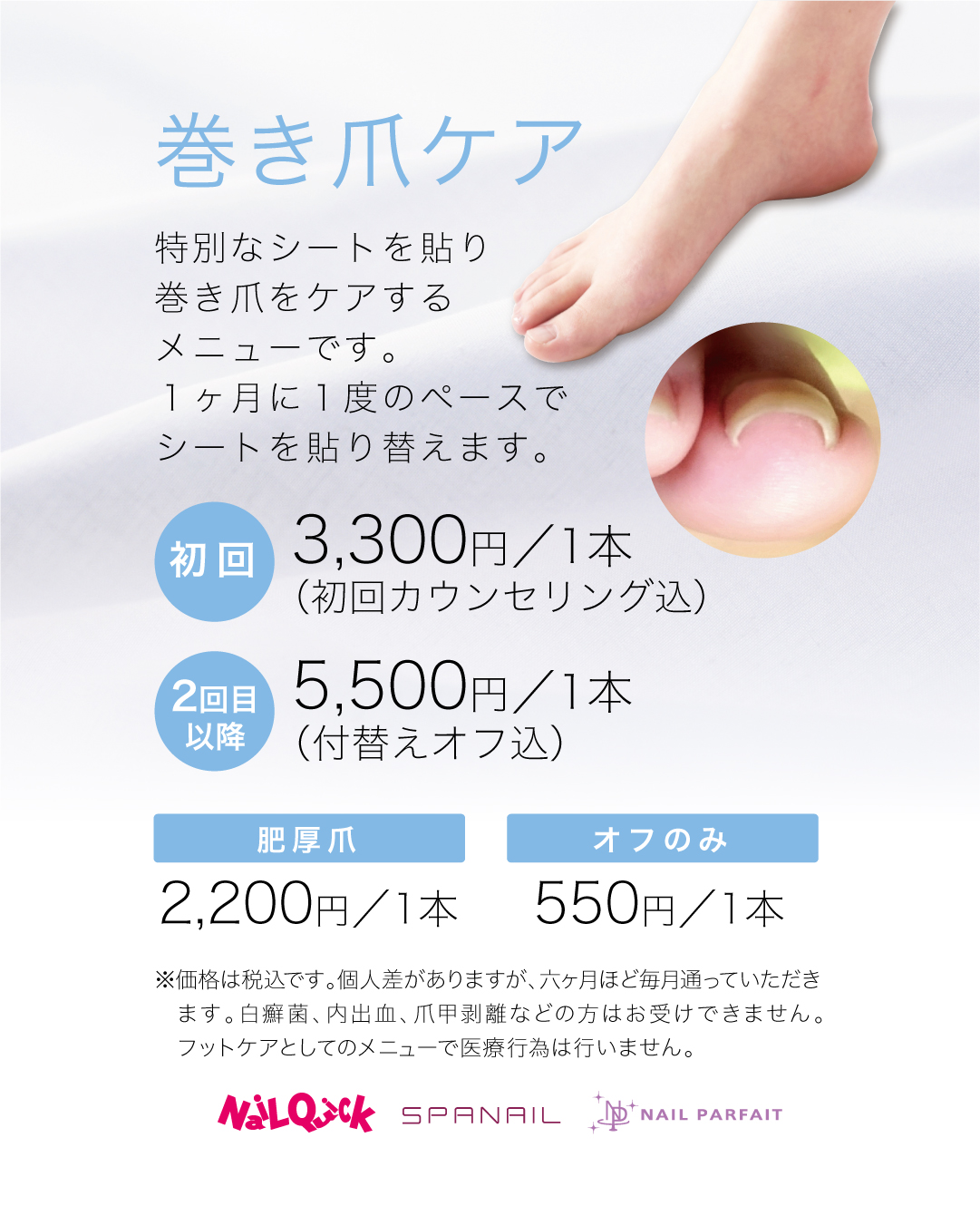 巻き爪ケア
