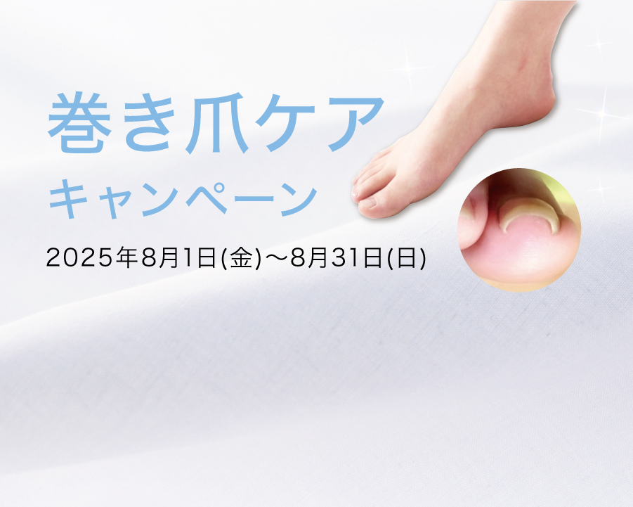 巻き爪ケアキャンペーン