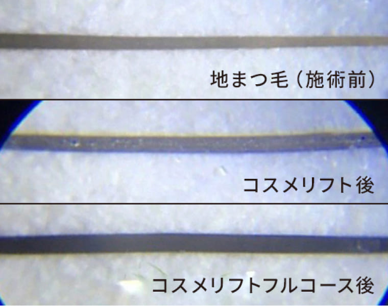 地まつ毛（施術前）・コスメリフト後・コスメリフトフルコース後の比較
